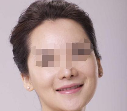 南昌哪家醫(yī)院做私密整形好 南昌哪家醫(yī)院做私密整形好