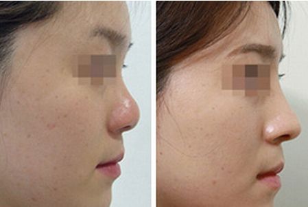 王佳琦醫(yī)生業(yè)務擅長？典型病例分享！