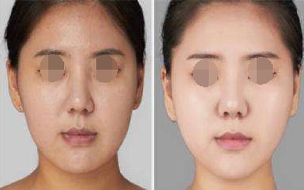 珠海博愛女子醫(yī)院整形外科項目全新推出，項目大揭秘
