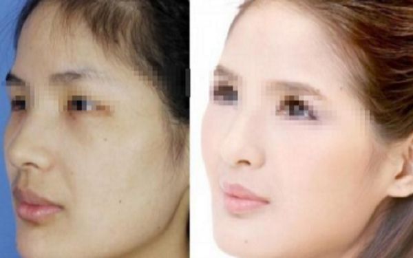 重慶美容整形科室推薦:挑選經(jīng)驗(yàn)豐富的專家最重要 重慶美容整形科室推薦:挑選經(jīng)驗(yàn)豐富的專家最重要