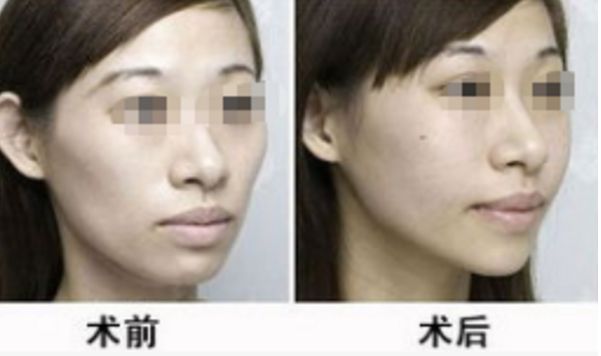 湖北地區(qū)整形醫(yī)院評選榜單，醫(yī)術(shù)高超排名靠前的醫(yī)療機(jī)構(gòu)