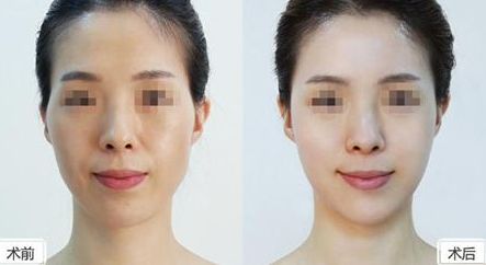 深圳美萊整形醫(yī)院位置介紹，牽手醫(yī)生，搶先體驗(yàn)熱門項(xiàng)目