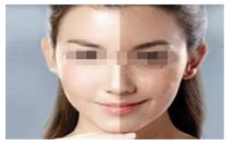 伊妍仕與儒白天使少女針大比拼，優(yōu)劣一目了然