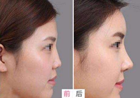 相山愛美爾醫(yī)療美容門診部，多項(xiàng)特色項(xiàng)目亮相，幫助您煥發(fā)美麗