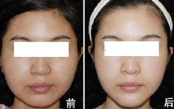 重慶市知名整形美容醫(yī)院榜單出爐！引領(lǐng)時尚潮流的醫(yī)療機(jī)構(gòu)盤點(diǎn)