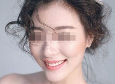 上海十大修復雙眼皮專家排行榜 上海十大修復雙眼皮專家排行榜