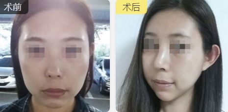 福州中聯(lián)美康醫(yī)療美容門診部的醫(yī)生技術(shù)及擅長(zhǎng)項(xiàng)目推薦 福州中聯(lián)美康醫(yī)療美容門診部的醫(yī)生技術(shù)及擅長(zhǎng)項(xiàng)目推薦