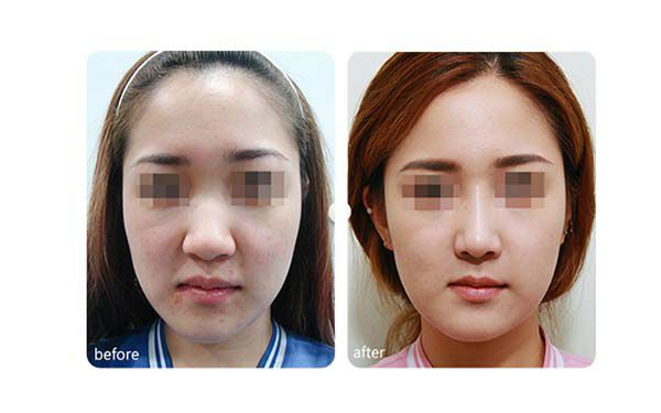 重慶最受歡迎的隆鼻醫(yī)院排行前八 重慶最受歡迎的隆鼻醫(yī)院排行前八