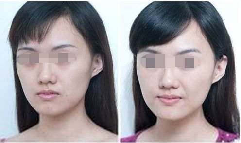 中山整形醫(yī)院八強名單公開！看看這些優(yōu)質(zhì)醫(yī)院是否入選受關(guān)注！