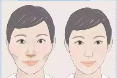 雙眼皮術(shù)后護(hù)理全攻略：埋線和全切有何異同？多久恢復(fù)自然？