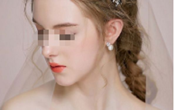 嘉興哪家美容醫(yī)院效果好 嘉興哪家美容醫(yī)院效果好