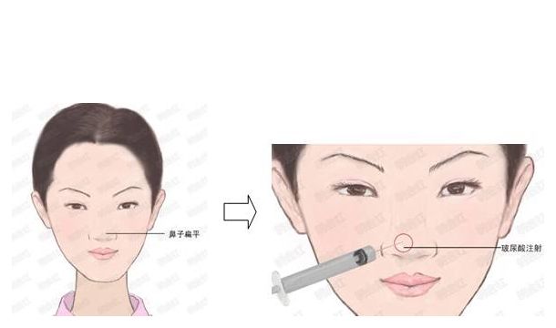 邯鄲萊媚儷整形：價(jià)格實(shí)惠，專業(yè)修復(fù)，雙眼皮、隆鼻等項(xiàng)目詳解！