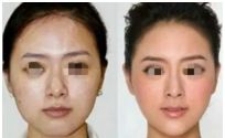 蘇州哪家整形美容醫(yī)院口碑好 蘇州哪家整形美容醫(yī)院口碑好