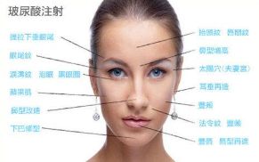 廈門熱瑪吉哪里好 廈門熱瑪吉哪里好
