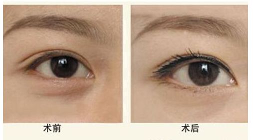 寧波市南湖區(qū)醫(yī)療美容知名醫(yī)院推薦，專家供您選擇