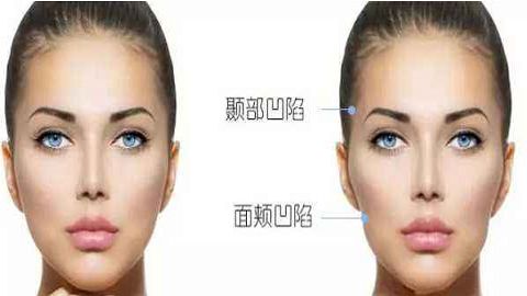 西安妃容醫(yī)療推薦的優(yōu)質(zhì)美容項(xiàng)目有哪些 西安妃容醫(yī)療推薦的優(yōu)質(zhì)美容項(xiàng)目有哪些