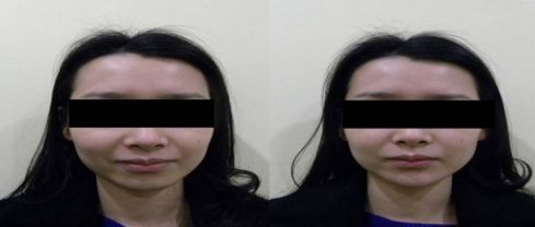 優(yōu)質(zhì)整形醫(yī)院排行榜，找哪家吸脂效果好？