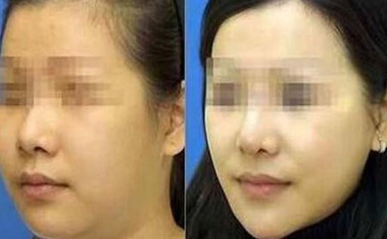 西昌愛麗諾醫(yī)療整形美容醫(yī)院綜合實力如何 西昌愛麗諾醫(yī)療整形美容醫(yī)院綜合實力如何