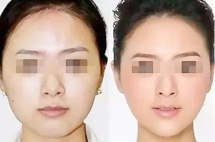 在廣東，如何選擇心儀的醫(yī)美機構(gòu)？（附醫(yī)院推薦）