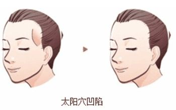 成都整形醫(yī)院排名前十名單整理，銅雀臺、米蘭柏羽何居首？