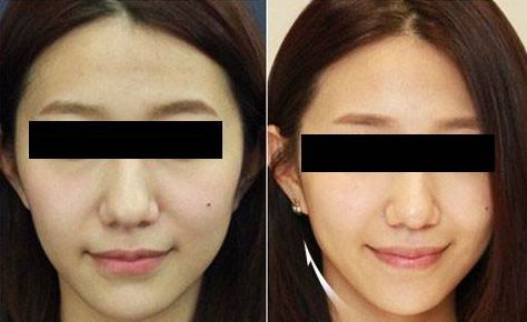 臨沂市哪家整形美容醫(yī)院口碑比較好？