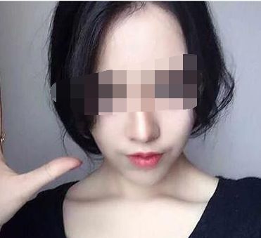 昆明市的美容整形醫(yī)院有哪些值得推薦？