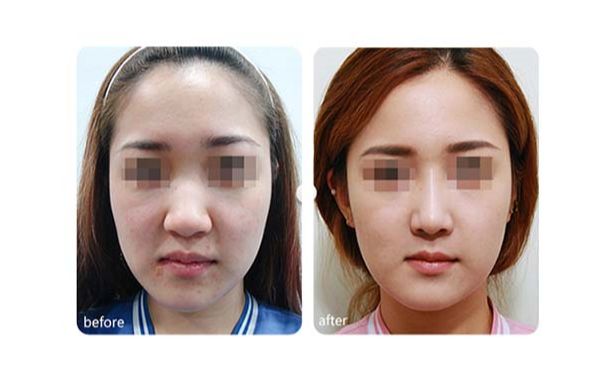 廣州優(yōu)質(zhì)磨骨整形醫(yī)院推薦！TOP10醫(yī)療機(jī)構(gòu)揭秘