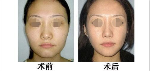 蘭州有哪些專業(yè)整形醫(yī)院值得去？