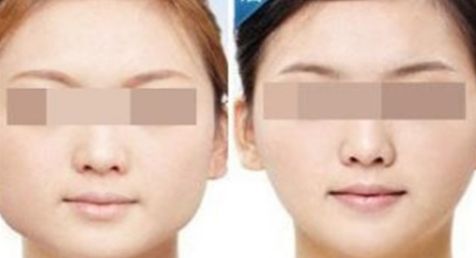 2024大連哪家醫(yī)院吸脂效果最好？這里有前十名匯總！