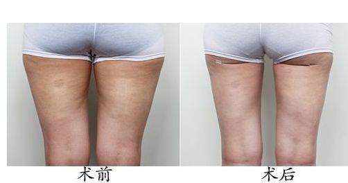 福州七家正規(guī)整形醫(yī)院綜合排名推薦 福州七家正規(guī)整形醫(yī)院綜合排名推薦
