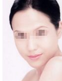 廣州哪家醫(yī)院吸脂做得好？看看排名前十的正規(guī)醫(yī)院