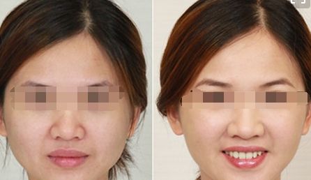 經(jīng)期護(hù)膚指南:讓美麗與周期同行 經(jīng)期護(hù)膚指南:讓美麗與周期同行