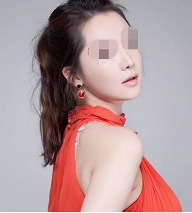 懷化哪家醫(yī)院可實施點陣激光治療 懷化哪家醫(yī)院可實施點陣激光治療