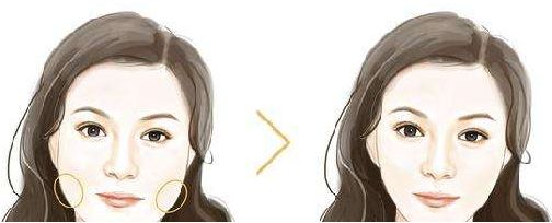 佛山生命加整形美容價格大揭秘，張春光元氣美狐眼等你了解