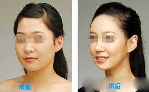 蘇州雙眼皮醫(yī)院口碑推薦排行榜 蘇州雙眼皮醫(yī)院口碑推薦排行榜
