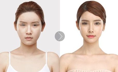北京植發(fā)醫(yī)院推薦，哪家效果好？
