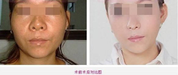 全新整容醫(yī)院推薦！這5家值得你關注