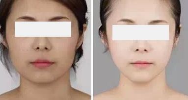 衢州雙眼皮整形醫(yī)院排行榜前八名匯總 衢州雙眼皮整形醫(yī)院排行榜前八名匯總