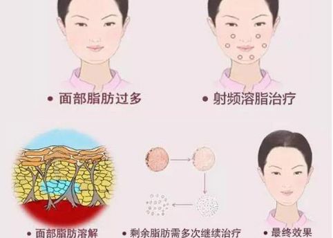 韓國(guó)整形醫(yī)院眼鼻綜合對(duì)比:普露菲耳 vs POP 韓國(guó)整形醫(yī)院眼鼻綜合對(duì)比:普露菲耳 vs POP