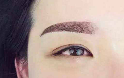 泉州眼部細(xì)紋微整醫(yī)生