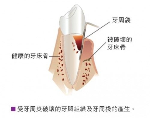 南寧自體細胞動感豐胸醫(yī)生