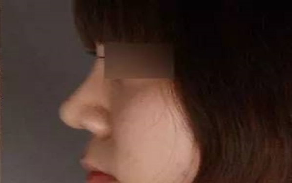 2023濟(jì)寧暢銷整形醫(yī)院匯總：抽脂技術(shù)亮眼，讓你輕松擁有完美身材！