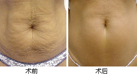 義烏整形醫(yī)院優(yōu)選TOP5，專業(yè)權(quán)威推薦，如何做出準(zhǔn)確選擇？深入了解為上策