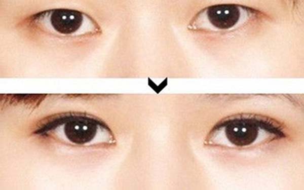 《青島哪家整形醫(yī)院的隆胸醫(yī)生口碑最好？匯總7位頂尖醫(yī)生！》