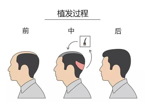 【獨(dú)家】年度最佳整形醫(yī)院盤點(diǎn)！2023連續(xù)六年蟬聯(lián)冠軍，匠心品質(zhì)贏得無(wú)數(shù)口碑推薦！