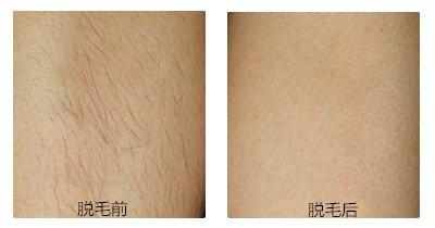 專業(yè)推薦！新疆頂級(jí)眼袋整形醫(yī)生綜合評(píng)價(jià)排行盤點(diǎn)