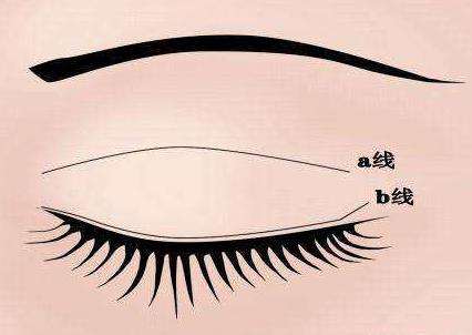 令人眼前一亮！遂寧多家雙眼皮整形醫(yī)院盤(pán)點(diǎn)，推薦陽(yáng)光、伊莎貝拉等知名品牌，一起來(lái)了解吧