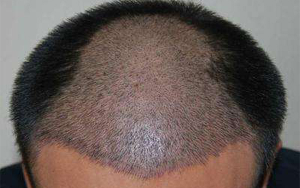 合肥眼袋手術(shù)醫(yī)院盤點(diǎn)，最具信賴的前五名現(xiàn)已公布！壹加壹榮登第三，藝星實(shí)力卓越，穩(wěn)居榜首位置！