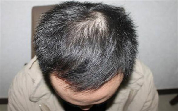 南昌三甲醫(yī)院全面盤點：專業(yè)美容整形醫(yī)院推薦，趕緊了解一下！