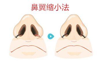 北京十大優(yōu)質(zhì)口腔醫(yī)院推薦，佳美第三醫(yī)院備受贊譽(yù)！中諾榜之精選參考
